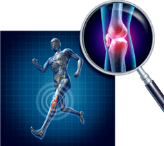 Artrosis of knee joint